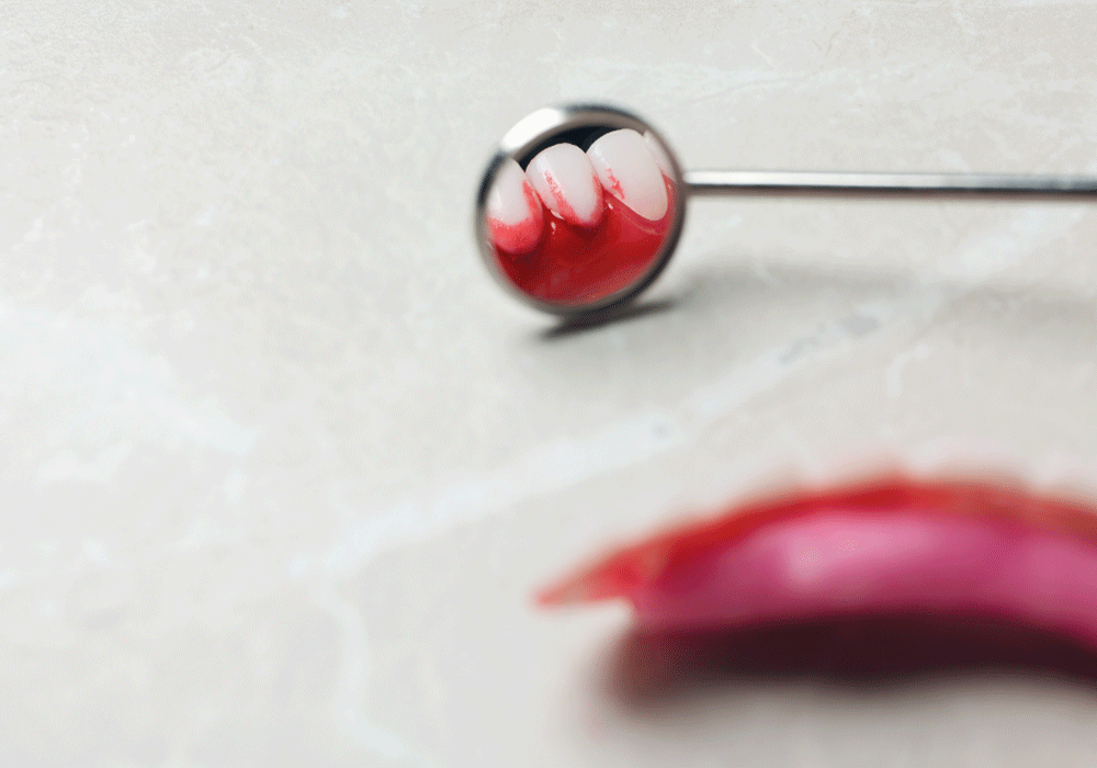 Bleeding Gums Why It Occurs & What to Do Point Clear Dental Associates